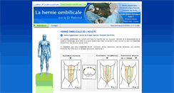 Desktop Screenshot of hernie-ombilicale.com
