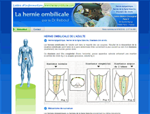Tablet Screenshot of hernie-ombilicale.com